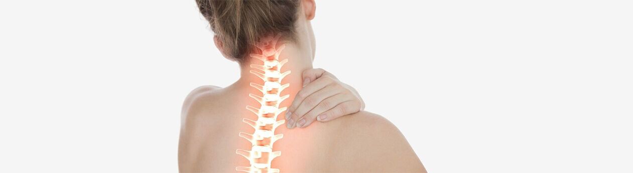 Osteochondrose der Halswirbelsäule bei einer Frau. 